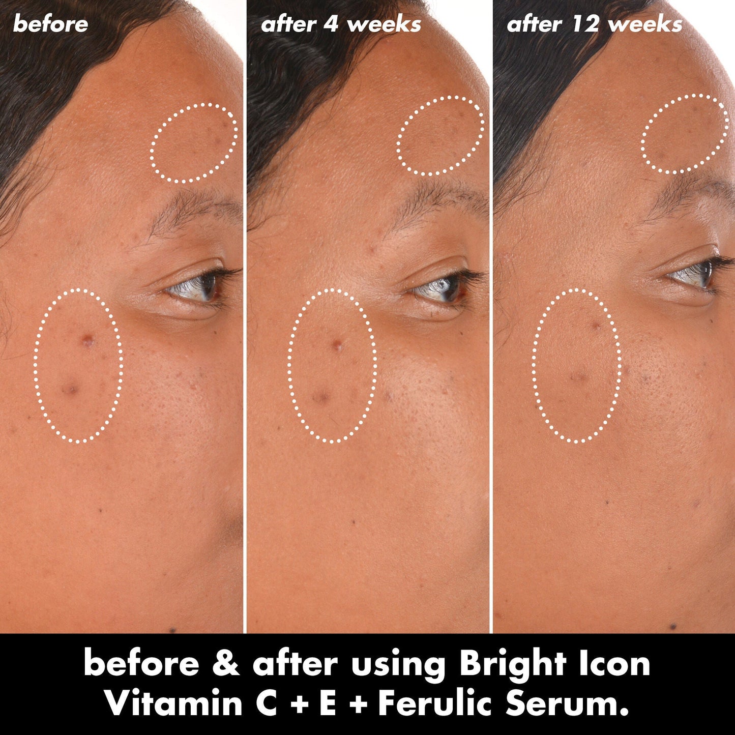 bright-icon-vitamin-c-e-ferulic-serum-y0 0226_EDU_BrightIconVitC_BA_Chanel_TRIPTYCH_c58f2fc8-209d-414f-9ba3-666a07a94887.jpg