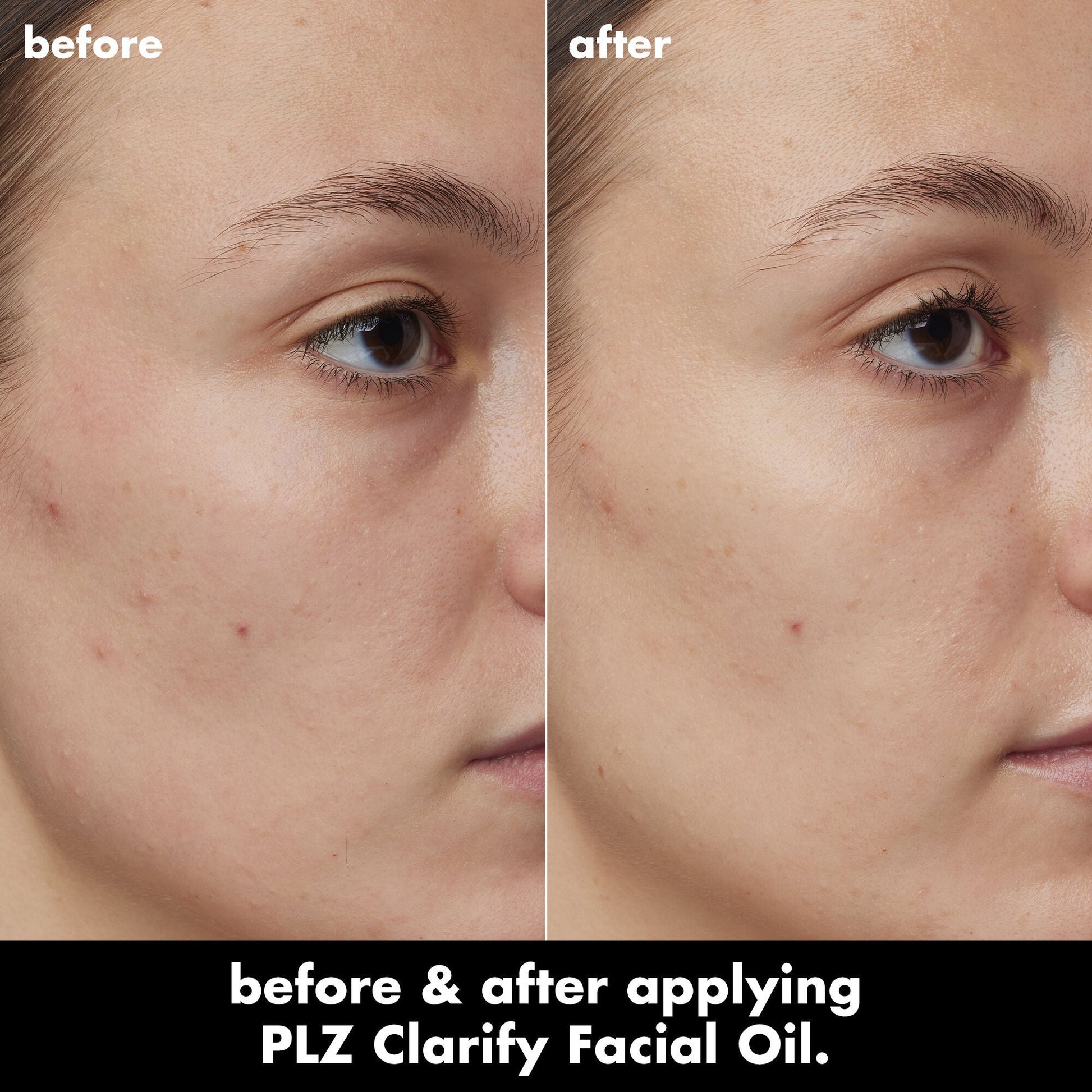 plz-clarify-facial-oil-z3 0326_EDU_PlzClarify_BA_Kelly.jpg