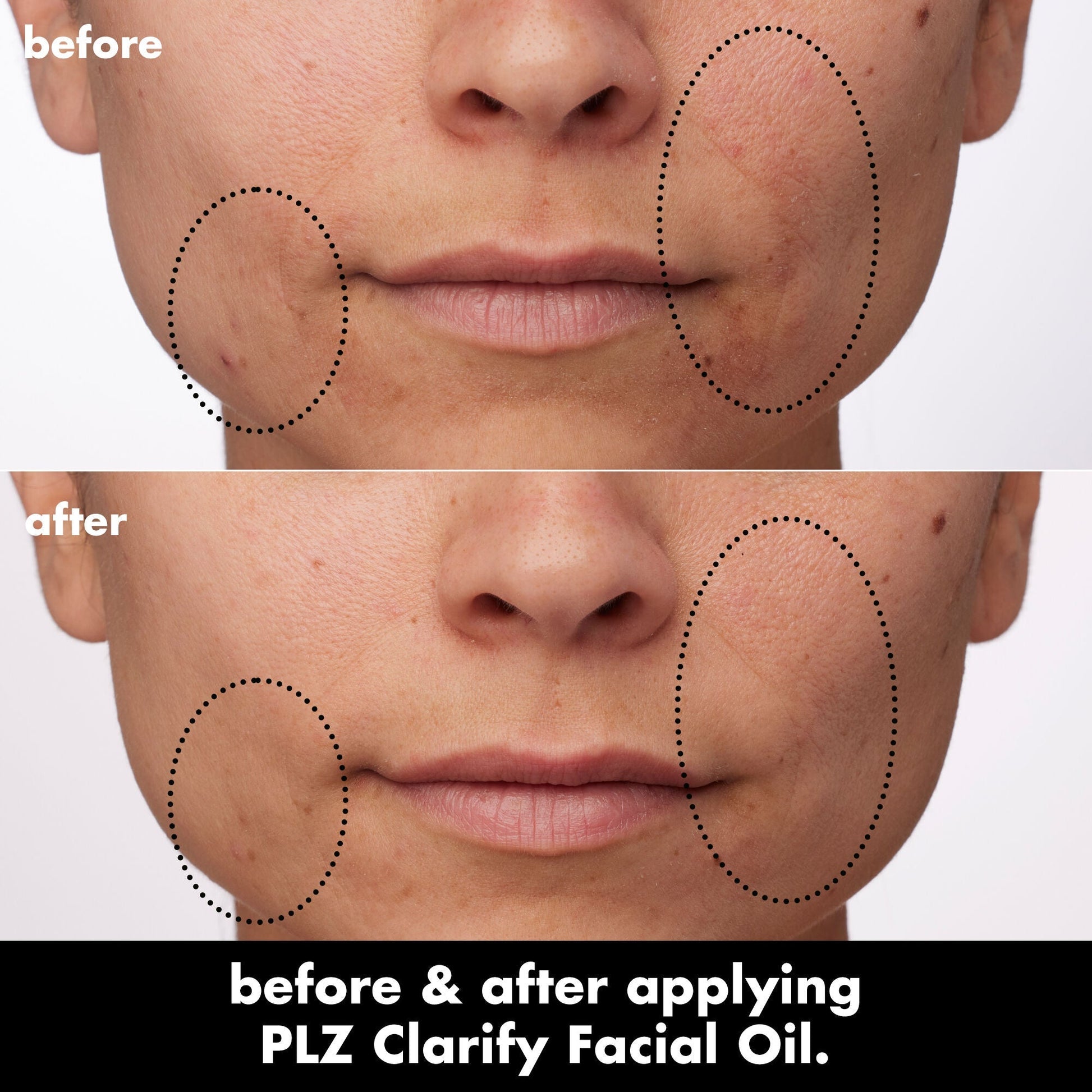 plz-clarify-facial-oil-z3 0326_EDU_PlzClarify_BA_Paula.jpg