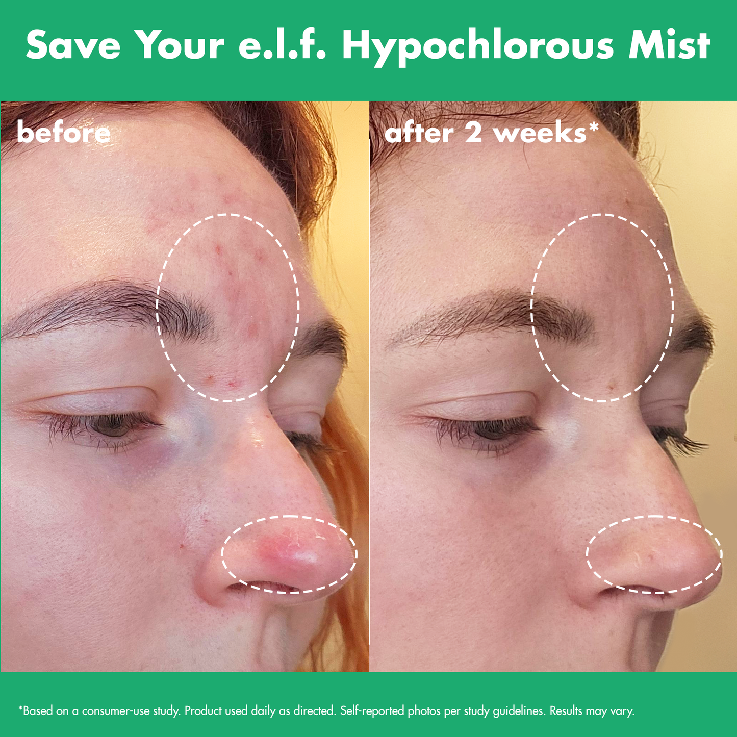 save-your-e-l-f-hypochlorous-mist-h3 FA26_EDUCATION_SAVEYOURELF_USAGE_BA1_WITHOUT_CLAIMS.png