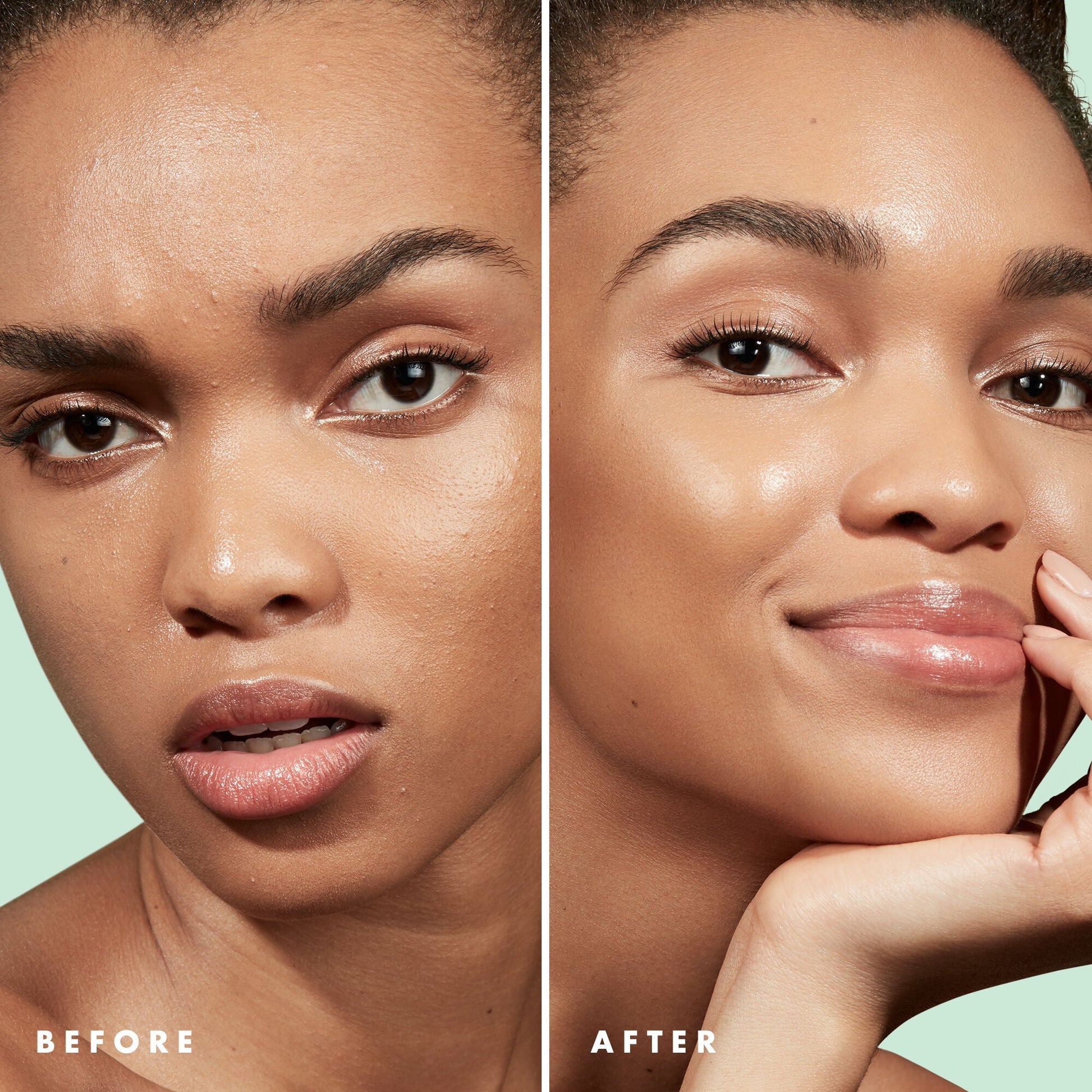 blemish-control-face-primer-large-size-k5 Primer_PP_Before_After_BlemishControl_2000x2000_3774231e-d4e1-49dd-b3d7-a73cbac901fe.jpg